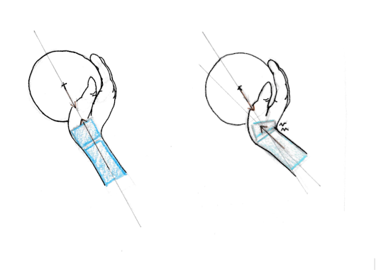 position du poignet pour le céramiste.