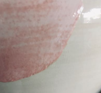 densité émail trop faible